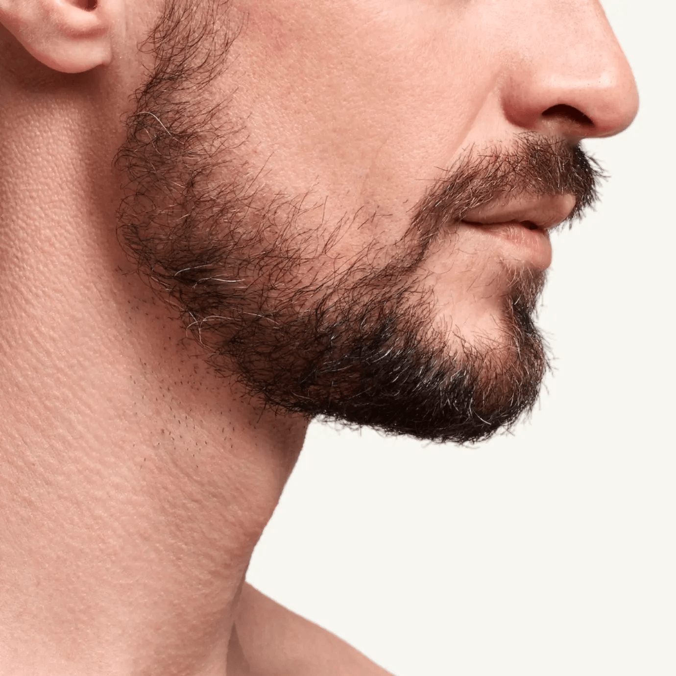 A patchy beard
