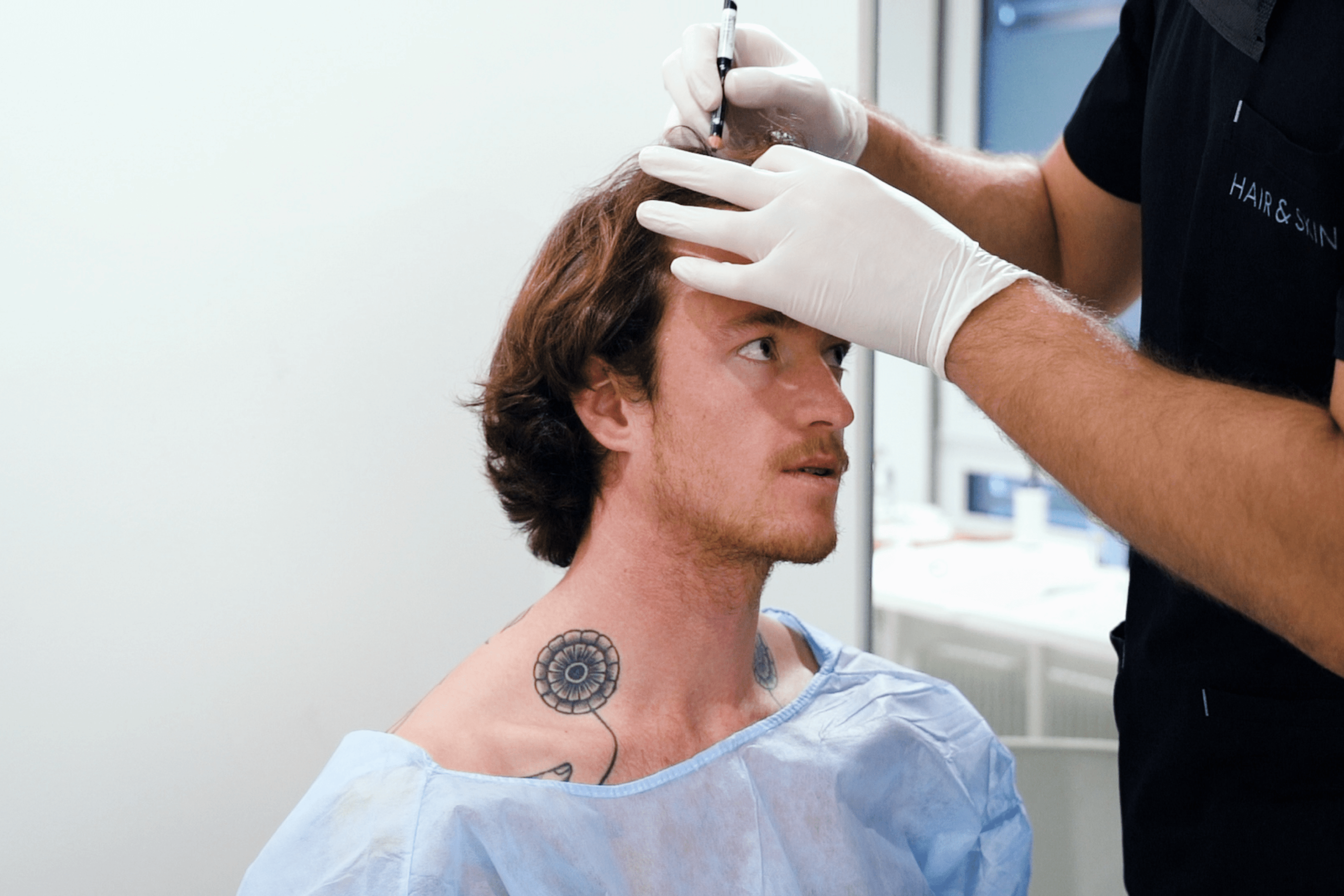 Doctor marking hairline on person